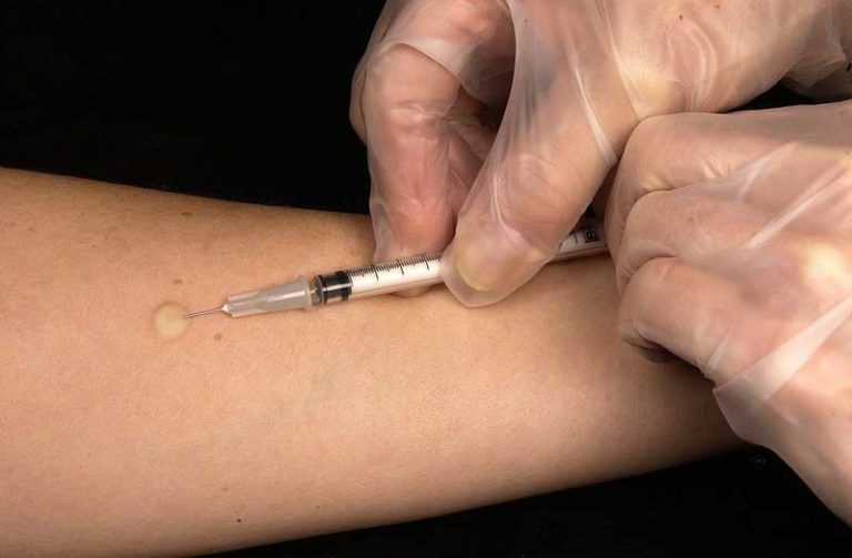 Neues Masernschutzgesetz: Viele müssen sich impfen lassen